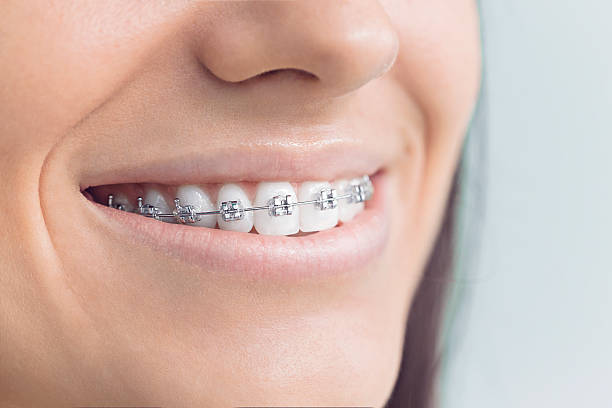 Best Pediatric Dentistry  in Pelican Bay, FL